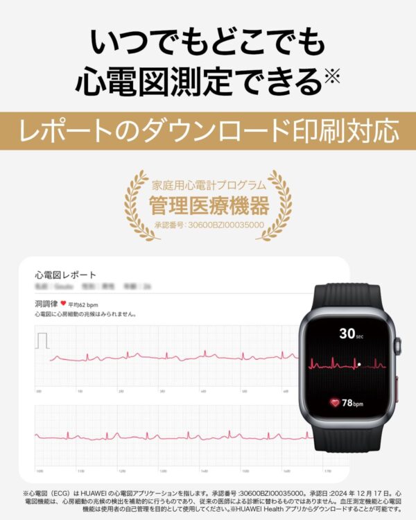 心電図